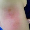 Thumbnail of related posts 025